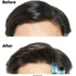 Kép 6/6 - Loreal Scalp Advanced sampon zsíros hajra, 300 ml
